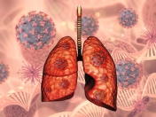 Rak płuc - czynniki ryzyka, profilaktyka i leczenie